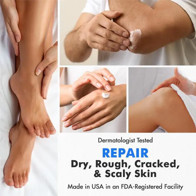 Alt view image 4 of 7 - Urea Cream 40% plus Salicylic Acid 2% for Dry Cracked Feet Skin