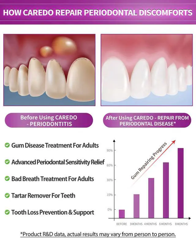 Alt view image 2 of 7 - Gum Toothpaste for Periodontitis, Gum Repair for Receding Gums, Gum Disease & Gingivitis Treatment, Periodontal Disease Treatment for Gum Health, Gum Disease Repair Bad Breath Toothpaste 3.52OZ