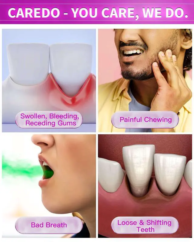 Alt view image 3 of 7 - Gum Toothpaste for Periodontitis, Gum Repair for Receding Gums, Gum Disease & Gingivitis Treatment, Periodontal Disease Treatment for Gum Health, Gum Disease Repair Bad Breath Toothpaste 3.52OZ