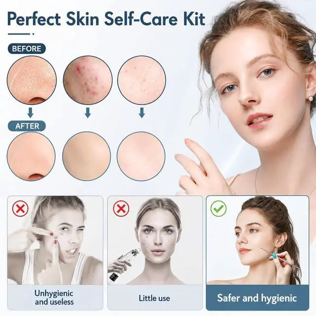 Alt view image 2 of 7 - Blackhead Remover Tools 10Pcs Pimple Popper Tool Kit, Blackhead Remover Extractor Tools, Anti-Slip Handle Pimple Comedone Extractor Acne Kit for Blackhead,Blemish,Zit Whitehead
