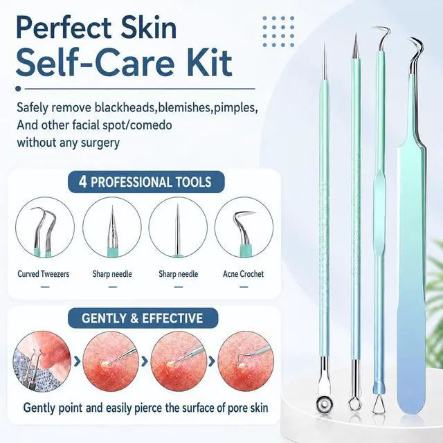 Alt view image 4 of 7 - Blackhead Remover Tools 10Pcs Pimple Popper Tool Kit, Blackhead Remover Extractor Tools, Anti-Slip Handle Pimple Comedone Extractor Acne Kit for Blackhead,Blemish,Zit Whitehead