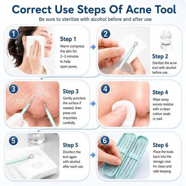 Alt view image 6 of 7 - Blackhead Remover Tools 10Pcs Pimple Popper Tool Kit, Blackhead Remover Extractor Tools, Anti-Slip Handle Pimple Comedone Extractor Acne Kit for Blackhead,Blemish,Zit Whitehead