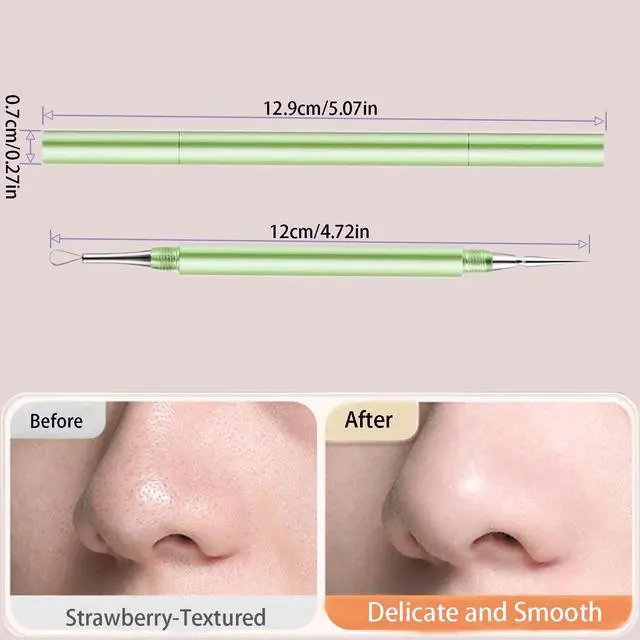 Alt view image 5 of 7 - 2-in-1 Professional Stainless Steel Acne Removal Needle, Whitehead&Blackhead Remover Tool, Pimples Comedone Extractor Removal Tool, Double Ended Needle with Cap Removal for Nose Face Tools(Rose Gold)
