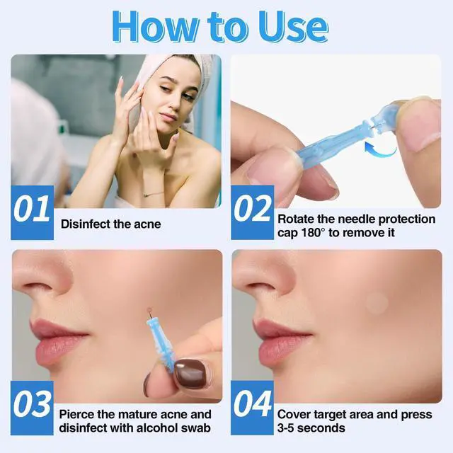 Alt view image 4 of 6 - Sterile Pimple Needle Kit - 80 pcs 0.3mm Ultra-Fine Acne Needles + 108 Dots Acne Pimple Stickers - Effective Blemish & Blackhead Removal Tools for Clear Skin