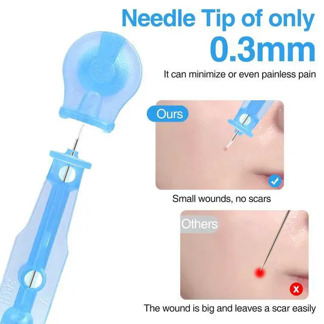 Alt view image 5 of 6 - Sterile Pimple Needle Kit - 80 pcs 0.3mm Ultra-Fine Acne Needles + 108 Dots Acne Pimple Stickers - Effective Blemish & Blackhead Removal Tools for Clear Skin