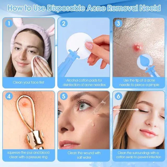 Alt view image 5 of 7 - 100PCS Disposable Blackhead Blemish Remover, Sterile Pimple Needles Pimple Popper Needles Tool for Acne, Whitehead, Closed Mouth Comedone Removal Clear Skin Suitable for Beauty Salon and Home
