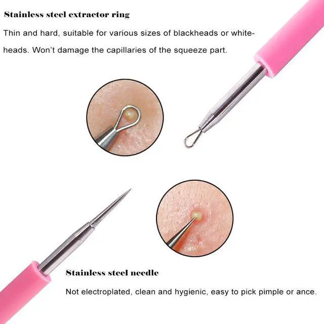 Alt view image 2 of 6 - Professional Acne Removal Needle, Whitehead & Blackhead Remover, Pimple Extractor Tool