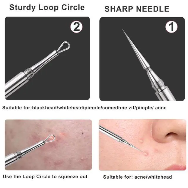 Alt view image 2 of 7 - Professional Facial Milia Removal and Whitehead Extractor & Lancet - Double Ended Circle Loop & Sharp Needle Pimple Popper Tool - 2-in-1 Blackhead & Blemish Remover - Zit and Pimple Acne Removal