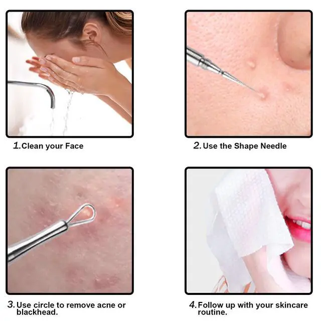 Alt view image 6 of 7 - Professional Facial Milia Removal and Whitehead Extractor & Lancet - Double Ended Circle Loop & Sharp Needle Pimple Popper Tool - 2-in-1 Blackhead & Blemish Remover - Zit and Pimple Acne Removal