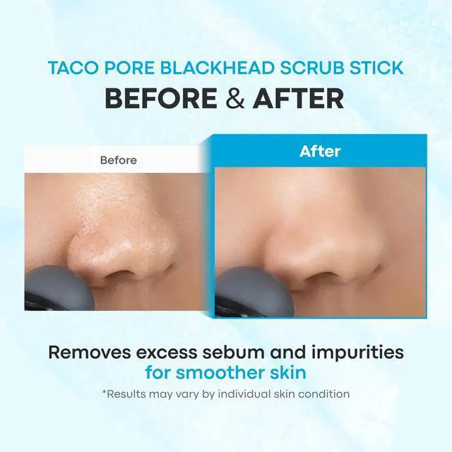 Alt view image 5 of 7 - Tako Pore Clay Scrub Stick, Korean Blackhead Exfoliator, 0.8 oz