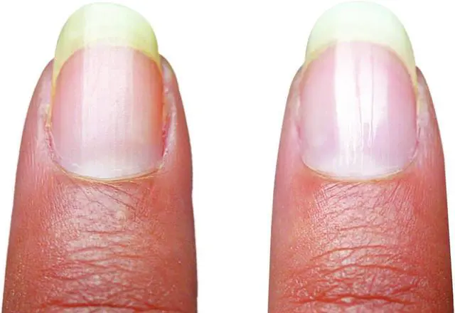 Alt view image 5 of 6 - Micro Nail Manicure or Mani Pedi--Smooths, Buffs & Shines Instantly