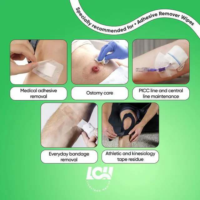 Alt view image 6 of 7 - 100CT Adhesive Remover Wipes Alcohol-Free No-Sting Medical Adhesive Remover for Skin 3"x2.5" 60 GSM Adhesive Remover Pads Effective Bandage, Dressings, Ostomy Adhesive Removers