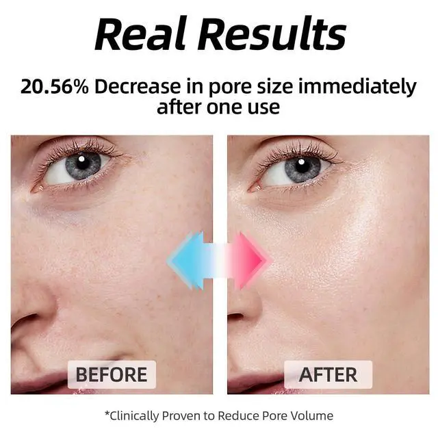 Alt view image 5 of 7 - Toner Pads - 60 Counts Exfoliating Face Pads with BHA & PHA for Acne & Breakouts, 40% Centella Asiatica for Sensitive Skin, Hydrating, Alcohol-Free, Korean Skin Care