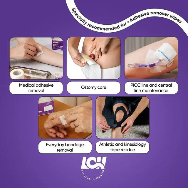Alt view image 6 of 6 - 100 CT Adhesive Remover Wipes Strong & Effective Skin Adhesive Remover 2 Ply 2.56x1.18in (6.5x3cm) Medical Adhesive Remover for Bandage, Tape, Dressings, and Ostomy Residue - By