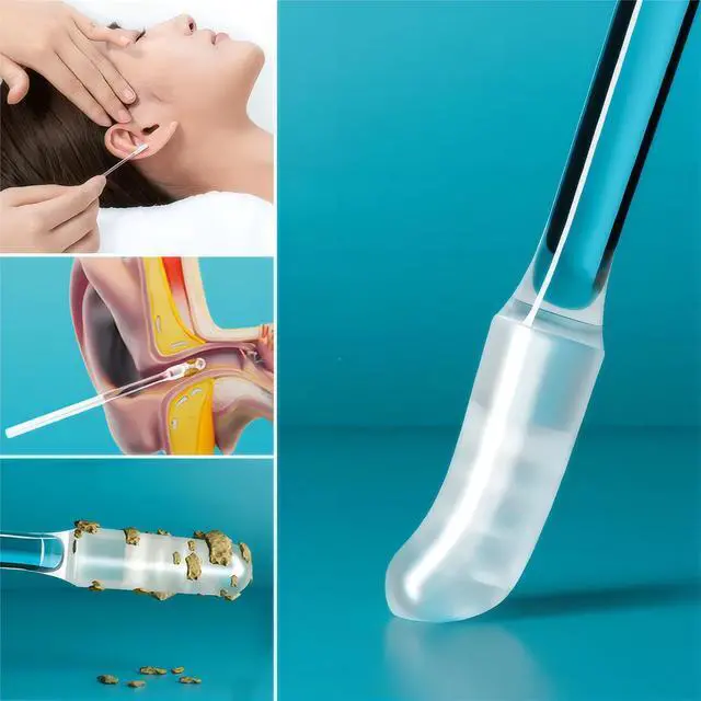 Alt view image 4 of 6 - Sticky Ear Cleaning Stick, 2026 New Reusable Ear Wax Removal Tools with Dust Cover Packaging, Earwax Removal Adhesive Swabs for Kids and Adults (Small, 24PCS)