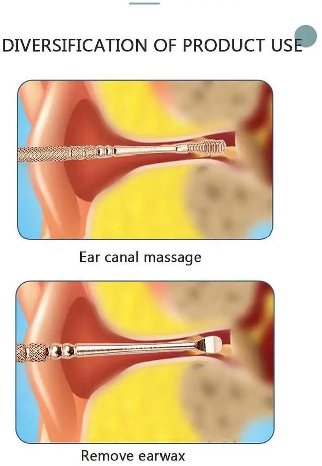 Alt view image 5 of 7 - Spring Ear Wax Cleaner Tool Set Ear Cleaner Ear Cleaner Tool Ear Wax Removal Spoon Double Ended with Stainless 360° Spiral Ear Massage Cleaning Tool Ear Cleaner Cleaning Brush and Storage Box 2PCS
