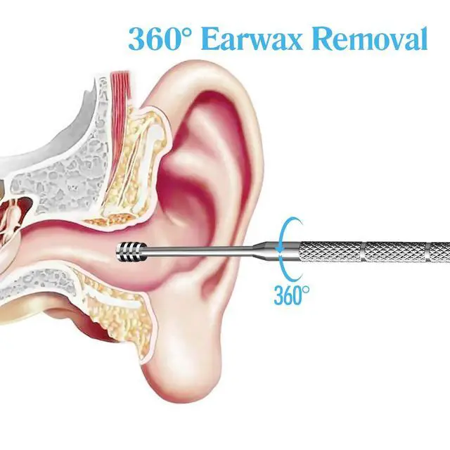 Alt view image 6 of 7 - Ear Pick Earwax Removal Kit, Ear Cleansing Tool Set, Ear Pick Ear Wax Remover Tool,Stainless Steel Ear Cleaner Curette,Earwax Removal Products with Storage Box 4 Pcs Set (Silvery)