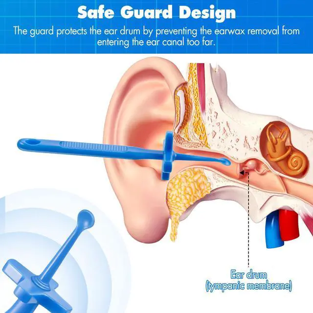 Alt view image 2 of 6 - 2 Pack Ear Wax Removal Tools with Safety Guard, Reusable Plastic Ear Picks | Safety Guard, Skin-Friendly Plastic, Rounded Smooth Edges, Non-Slip Grip, Hanging Storage, Safe and Easy Earwax Removal
