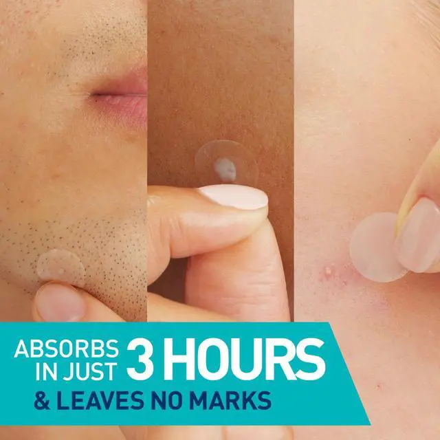 Alt view image 2 of 7 - CeraVe Hydrocolloid Pimple Patches with Niacinamide, Ultra-Thin, 22ct | Absorbs Oil with Niacinamide and Ceramides, Ultra-Thin Acne Patches That Blend Into All Skin Tones, For Sensitive Skin