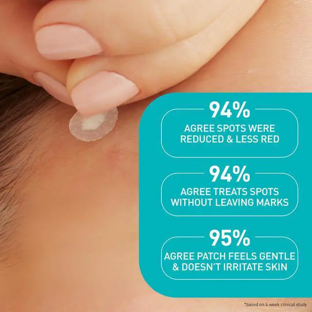 Alt view image 7 of 7 - CeraVe Hydrocolloid Pimple Patches with Niacinamide, Ultra-Thin, 22ct | Absorbs Oil with Niacinamide and Ceramides, Ultra-Thin Acne Patches That Blend Into All Skin Tones, For Sensitive Skin