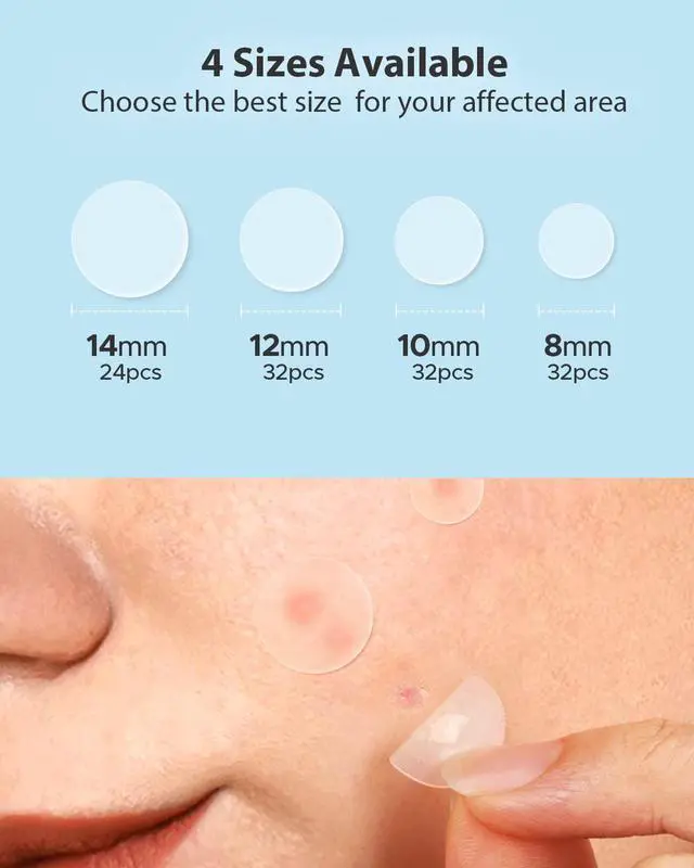 Alt view image 5 of 7 - LitBear Acne Pimple Patches- Day and Night 4 Sizes 180 Dots Thin & Thick Hydrocolloid Patches with Witch Hazel, Tea Tree & Calendula Oil, Pimple Stickers for Covering Zits, Spots, Acne Dots