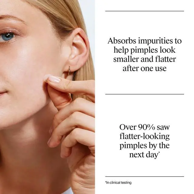 Alt view image 3 of 7 - Neutrogena Stubborn Acne Patches, Ultra-Thin Pimple Patches, 24 Ct | Hydrocolloid Absorbs Impurities, Ultra-Thin, Works Overnight, Pimple Patches