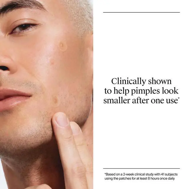 Alt view image 7 of 7 - Neutrogena Stubborn Acne Patches, Ultra-Thin Pimple Patches, 24 Ct | Hydrocolloid Absorbs Impurities, Ultra-Thin, Works Overnight, Pimple Patches