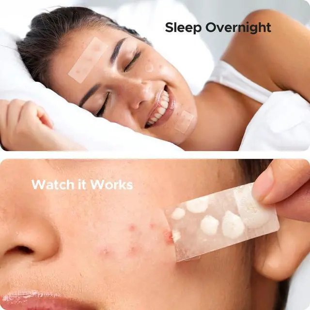 Alt view image 4 of 7 - TKTK Large Pimple Patches for Face & Body Zit Breakouts, 7 Sizes 126 Count | XL Acne Patch, for Chin, Forehead, Chest, Back, Big Hydrocolloid Bandages, Square / Strip / Dot Shapes, for All Skin Types
