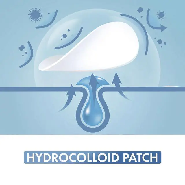 Alt view image 7 of 7 - Hellados 450 Pimple Patches For Face, 4 Size Acne Patches, Hydrocolloid Zit Patches, Blemish Patches, Spot Stickers with Tea Tree Oil and Calendula Oil