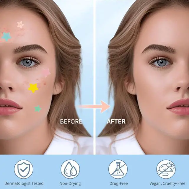 Alt view image 4 of 7 - QUSTERE Pimple Patches for Face, Hydrocolloid Acne Patches, Cute Star Zit Covers, Colorful Spot Stickers with Tea Tree, Salicylic Acid & Cica Oil| 3 Sizes (10mm, 12mm & 14mm) |200 Count