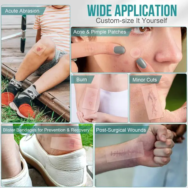 Alt view image 4 of 7 - Hydrocolloid Roll for Wound Care, Hydrocolloid Patch Bandages with Self-Adhesive, Bed Sore Bandages, Highly Absorbent & Waterproof for Burn, Blister, Acne Care, First Aid Kit Essential (2in x 12ft)