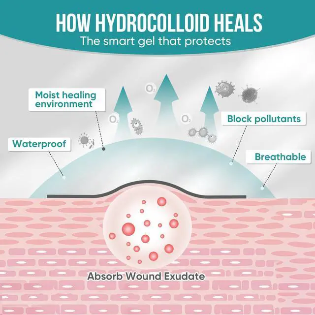 Alt view image 7 of 7 - Hydrocolloid Roll for Wound Care, Hydrocolloid Patch Bandages with Self-Adhesive, Bed Sore Bandages, Highly Absorbent & Waterproof for Burn, Blister, Acne Care, First Aid Kit Essential (2in x 12ft)