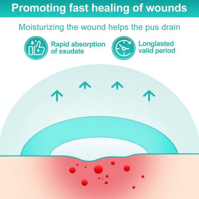 Alt view image 2 of 7 - Hydrocolloid Dressing 4" x 4" for Wound Care, 10 Pcs Large Patch Bandages with Self-Adhesive for Bedsore, Burn, Blister, Acne Care, Super Absorbent for Fast Healing