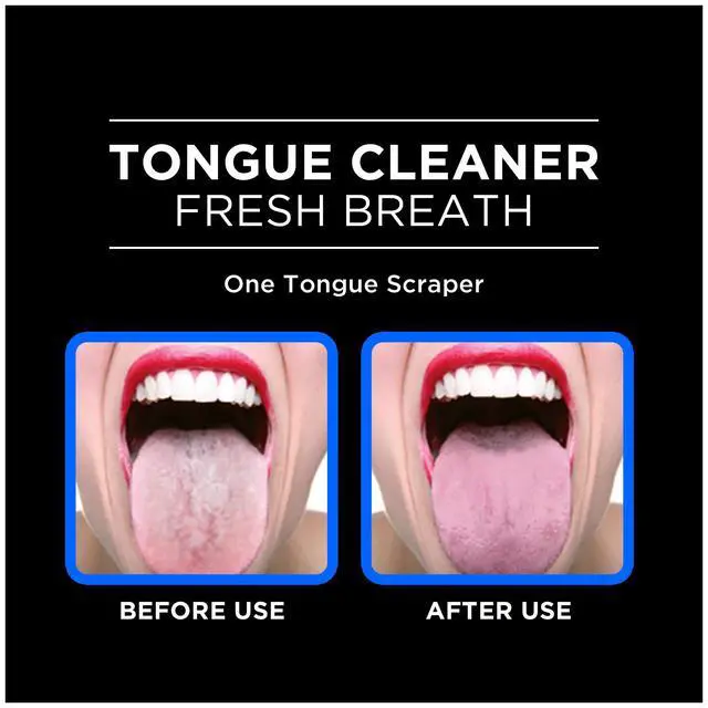 Alt view image 3 of 6 - DenTek Tongue Scraper, Gentle Tongue Cleaner Brush, 2ct | Orabrush Fresh Breath, Fights Bad Breath, BPA-Free Tongue Scraper, Reaching Where a Toothbrush Cannot