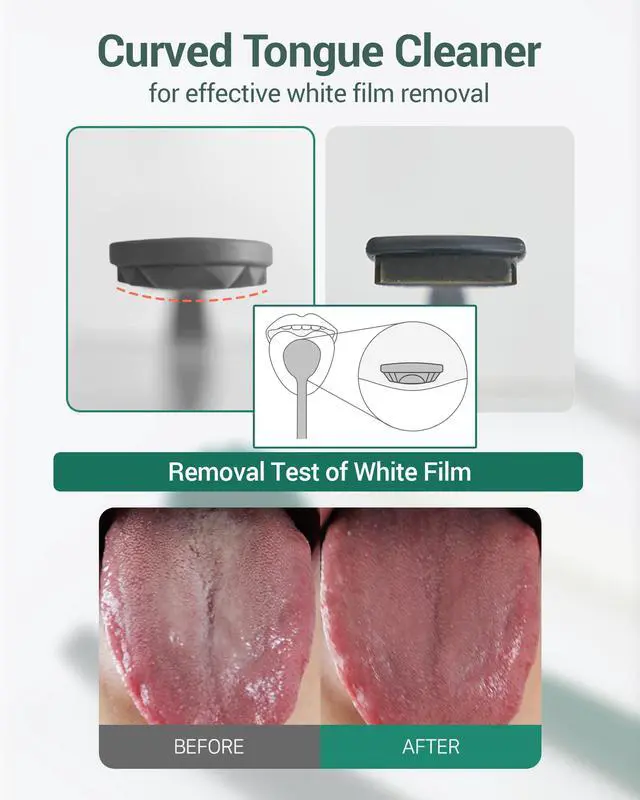 Alt view image 3 of 7 - Tongue Scraper with 3 Replaceable Heads for Up to 9 Months - Soft BPA-Free TPE Tongue Cleaner, Designed to Reduce Gag Reflex, Helps Freshen Breath & Remove White Coating (Deep Gray)