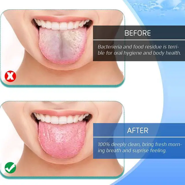 Alt view image 4 of 7 - 4PCS Tongue Scraper, Stainless Steel Tongue Cleaners, 100% BPA Free Fresher Tongue Tools, Healthy Oral Hygiene Brushes, Medical Grade Reusable Stainless Steel, Eliminate Bad Breath