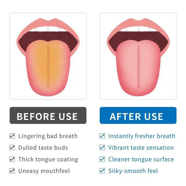 Alt view image 6 of 7 - Tongue Cleaner, Tongue Scraper, Disposable, Plastic Scraper, Clean Tongue, Promote Fresh Breath, Includes Safe Fold- Back Tooth Pick, 100 Count