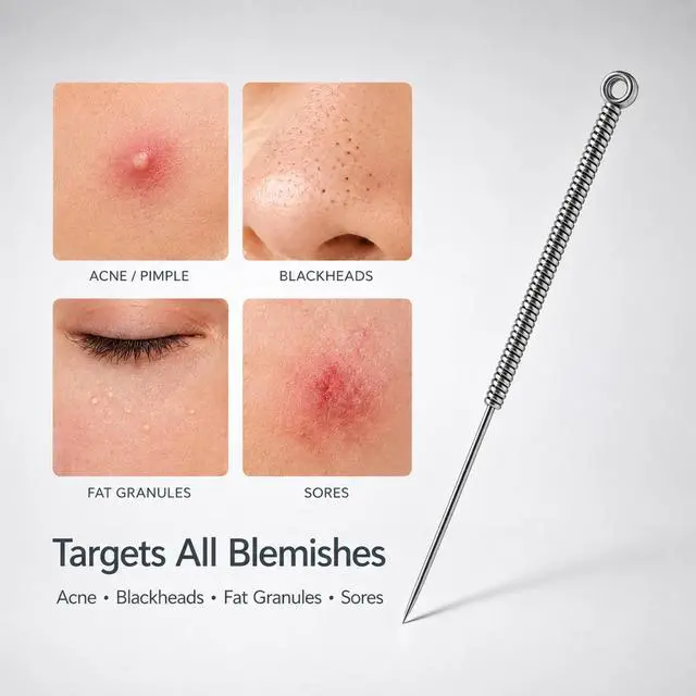 Alt view image 4 of 7 - 100 Pcs Disposable Acne Needles, Blackhead Remover Tools | Blackhead Remover Tools for Acne and Blemishes, Acne Popper Tools, Stainless Steel Comedone Extractor