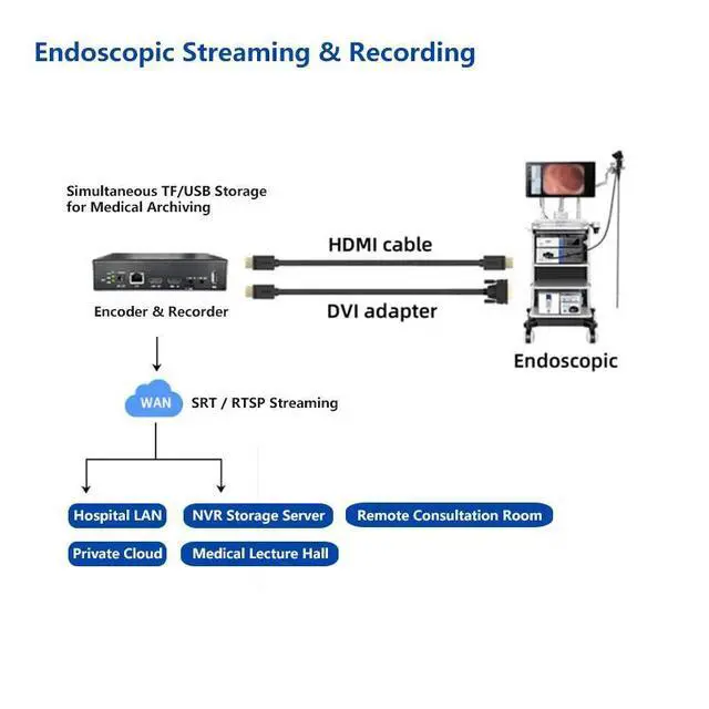 Alt view image 4 of 5 - 4K60 HDMI Encoder with Loopout - 1080P@60fps H.265/H.264 Video Streamer - Supports SRT, RTMP, RTSP, WebRTC, GB28181 - OSD Overlay for Live Streaming, Security