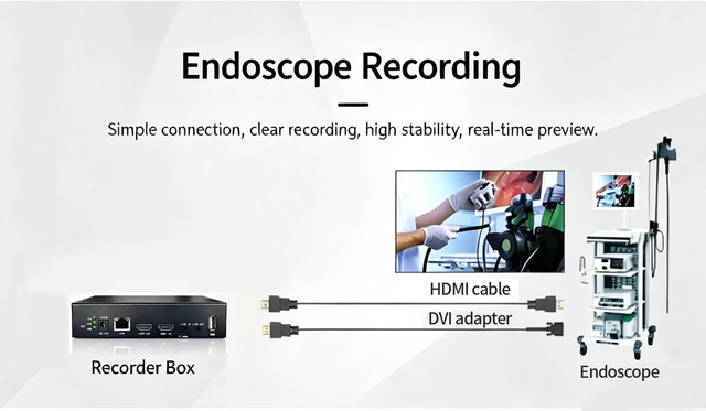 Alt view image 3 of 6 - 1080P 60fps HDMI Video Capture & Recorder Box - HD Video Capture for Gaming, TV Set-Top Box & PC Program Recording with HDMI Loop-Out