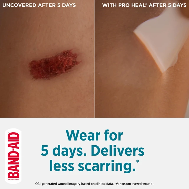 Alt view image 4 of 6 - BAND-AID Pro Heal 5 Day Protect Hydrocolloid Bandages, One Size, 10 Count
