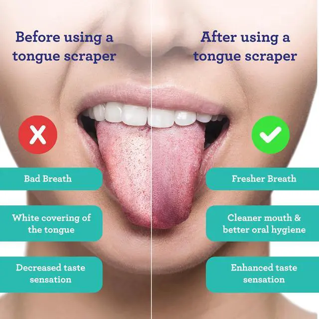 Alt view image 2 of 6 - Tongue Scraper for Adults (2 Pack) with Travel Case, 420 Medical-grade 100% Stainless Steel Tongue Cleaner, Aids in Fresh Breath & Oral Care