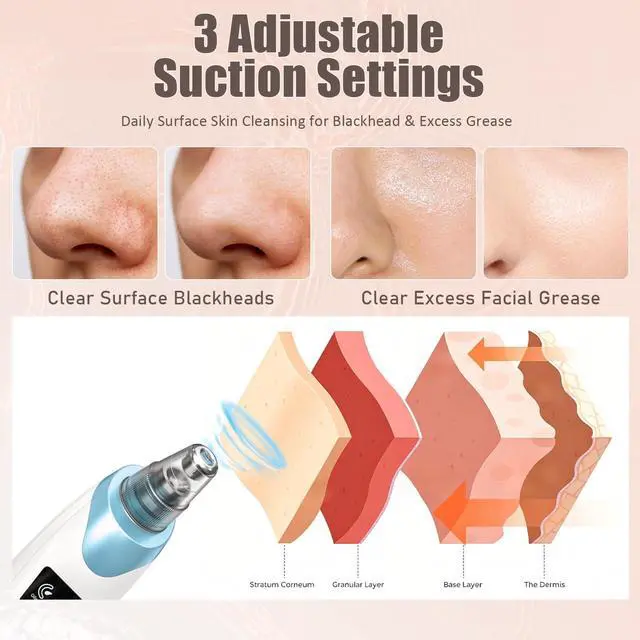 Alt view image 3 of 6 - Blackhead Remover Pore Vacuum,Facial Pore Cleaner Blackhead Vacuum (Blue) | 5 Suction Power,5 Probes,USB Rechargeable Pore Vacuum Tool for Adult