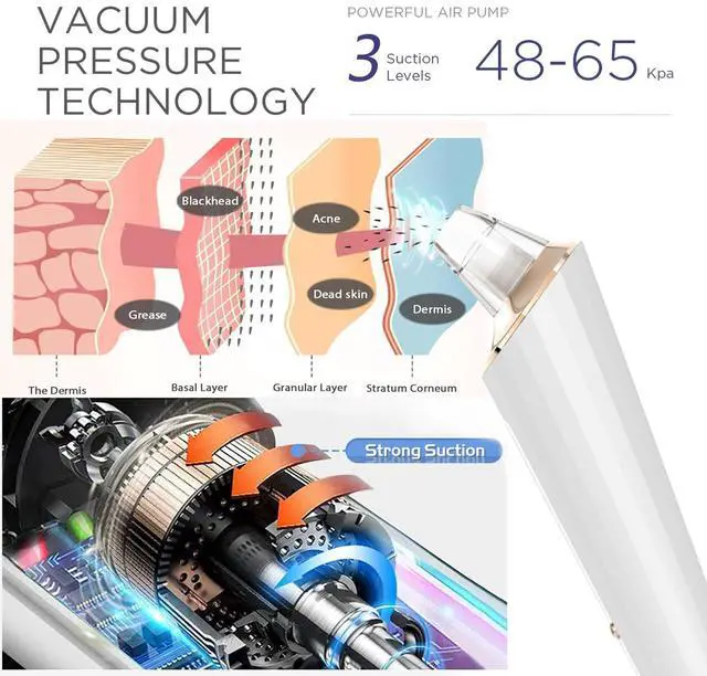 Alt view image 2 of 7 - Blackhead Remover Pore Vacuum, Upgraded USB Rechargeable Facial Pore Cleaner Blackhead Removal Kit with 3 Suction Power,5 Probes Black Head Extractions Tool for Women & Men (Snowy)
