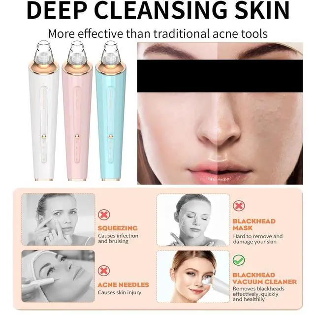 Alt view image 5 of 7 - Blackhead Remover Pore Vacuum, Upgraded USB Rechargeable Facial Pore Cleaner Blackhead Removal Kit with 3 Suction Power,5 Probes Black Head Extractions Tool for Women & Men (Snowy)