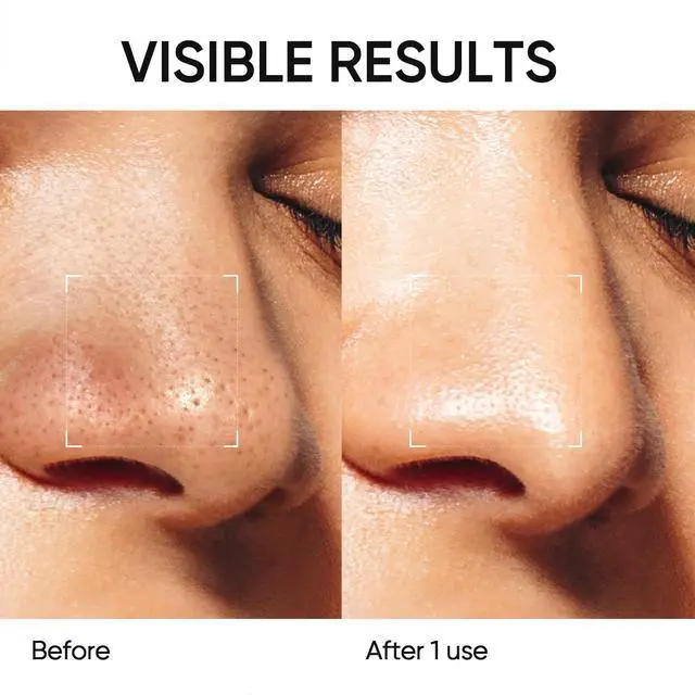 Alt view image 4 of 7 - Deep Pore Cleansing Blackhead Remover Face Mask Stick, Mud Mask with Natural Alaska Volcano Clay, Gentle Exfoliating, Smoothing Skin, Non-Drying, Skincare Facial Mask