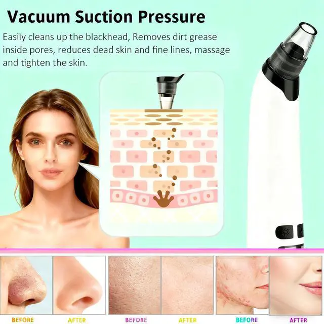 Alt view image 6 of 6 - Blackhead Remover Pore Vacuum,Deeply Black Head Remover for Face,4 Pore Sucker Tools,3 Adjustable Suction Levels LED Display, USB Charging with hot Compress Extractor Tool for Women & Men