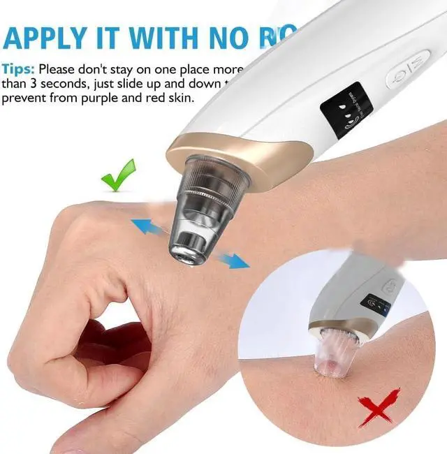 Alt view image 7 of 7 - Blackhead Remover Vacuum - Professional Blackhead Extractor for Face with 3 Adjustable Suction Levels, USB Rechargeable Pore Cleaner, and 5 Interchangeable Probes (Off-White)