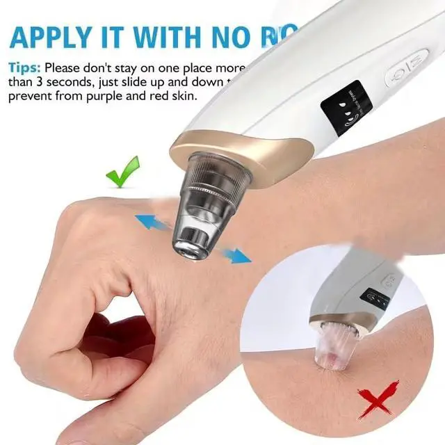 Alt view image 2 of 7 - Blackhead Remover Pore Vacuum, Professional Blackhead Extractor for Face with 3 Adjustable Suction Levels, USB Rechargeable Pore Cleaner, and 5 Interchangeable Probes, Birthday Holiday Gift