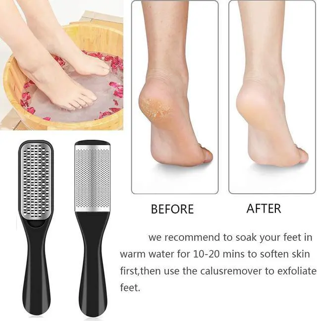 Alt view image 4 of 7 - 36 in 1 Pedicure Kit, Stainless Steel Foot Care Kit with Foot File | Professional pedicure kit with foot file, foot rasp, callus remover, nail clipper and cuticle pusher for home spa care.